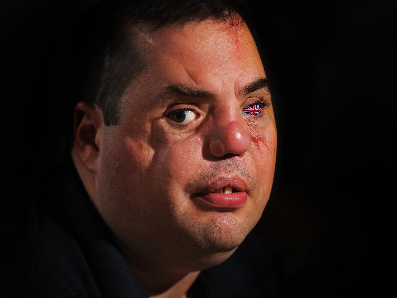Veteran Simon Brown, from Morley, was blinded by sniper fire in Iraq in 2006. Image: Tony Johnson