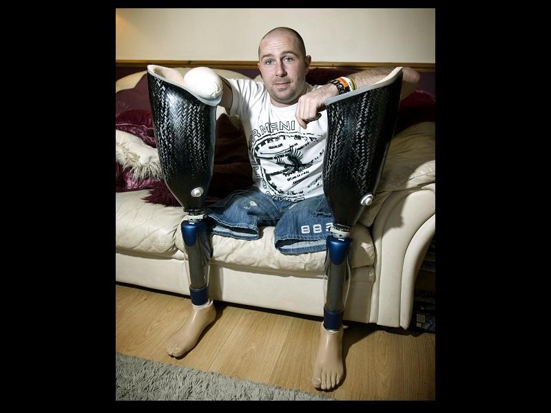 Afghan veteran Dave Watson marched at a medal parade, just six months after losing both legs and right arm in a bomb blast in Afghanistan. He was fitted with prosthetic legs and an arm.