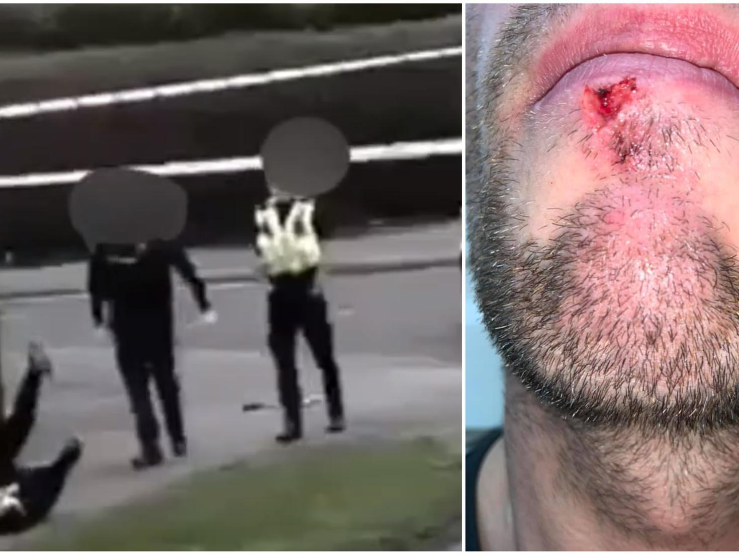 David Baldwin, 31, claims he was pushed to the ground, hit and grabbed around the throat by a West Yorkshire Police officer while filming an incident in Seacroft on Saturday