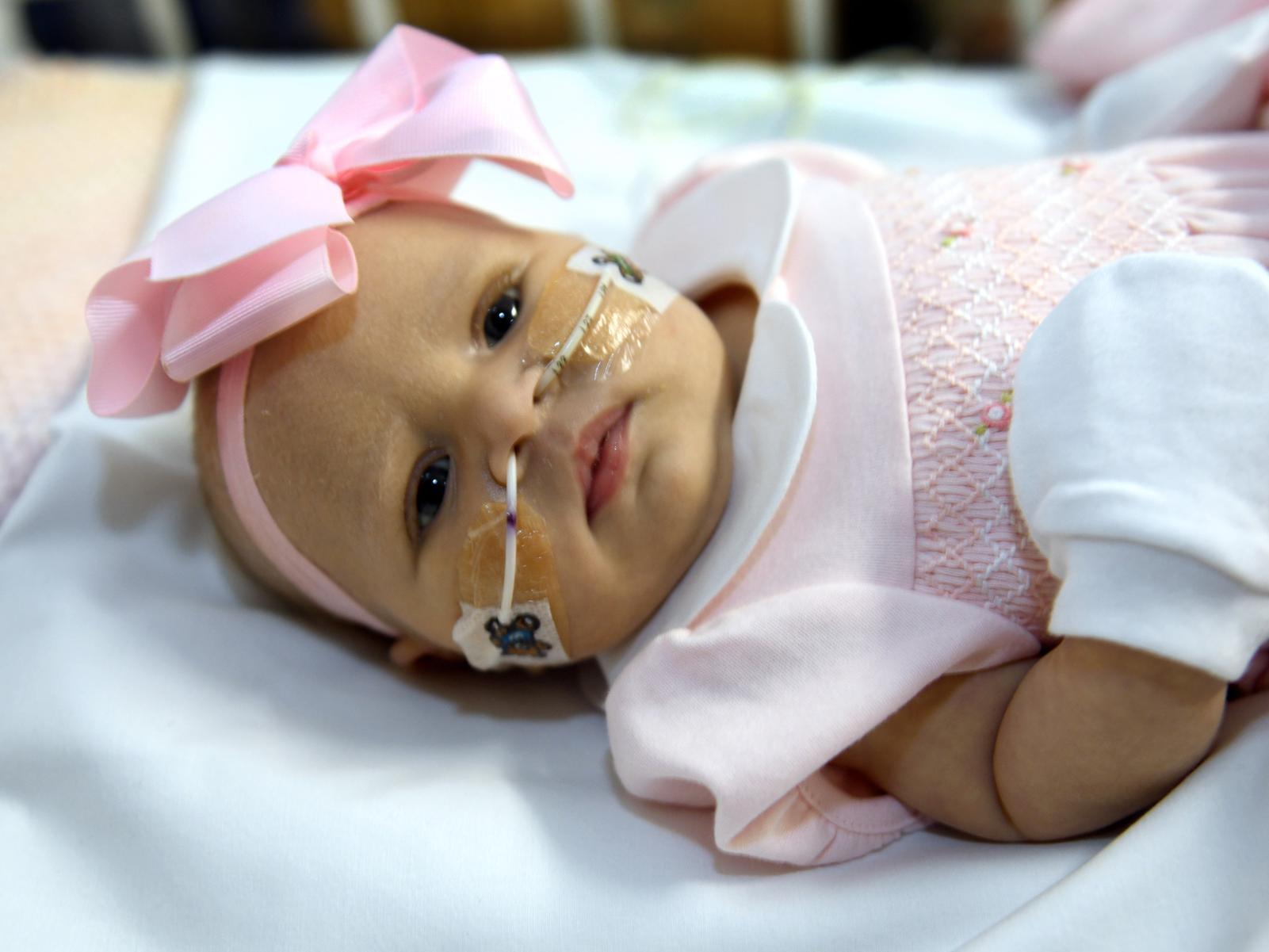 Little Arabella Irvine has a rare heart defect and is being treated in the Leeds Children's Hospital.